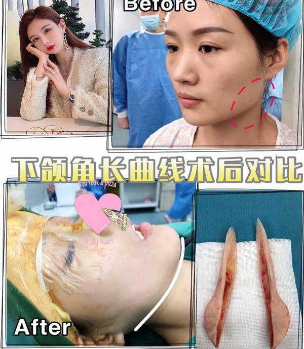 金一秀磨骨