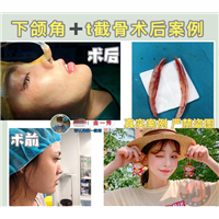 金一秀