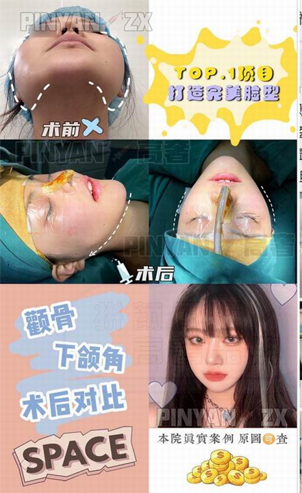 金一秀
