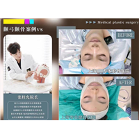 张柱允磨骨专家
