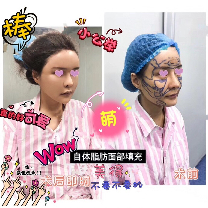李文芳
