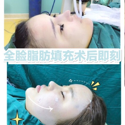 李文芳