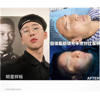 南昌鼻综合整形