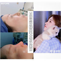南昌鼻综合整形