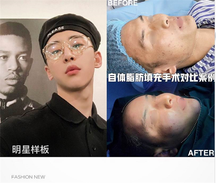 南昌鼻综合整形