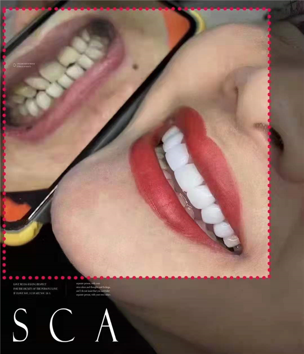 广州美牙培训