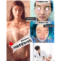 张柱允磨骨专家