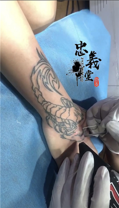 赣州洗纹身遮盖疤痕 