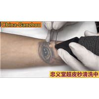 赣州洗纹身价格多少 
