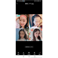 厦门毛发移植专家