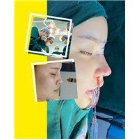 深圳鼻综合整形