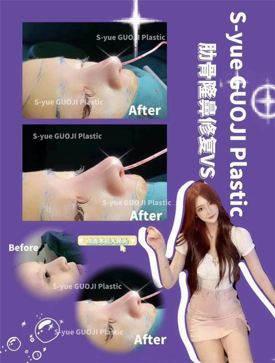 上海鼻综合整形