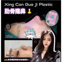 上海鼻综合整形