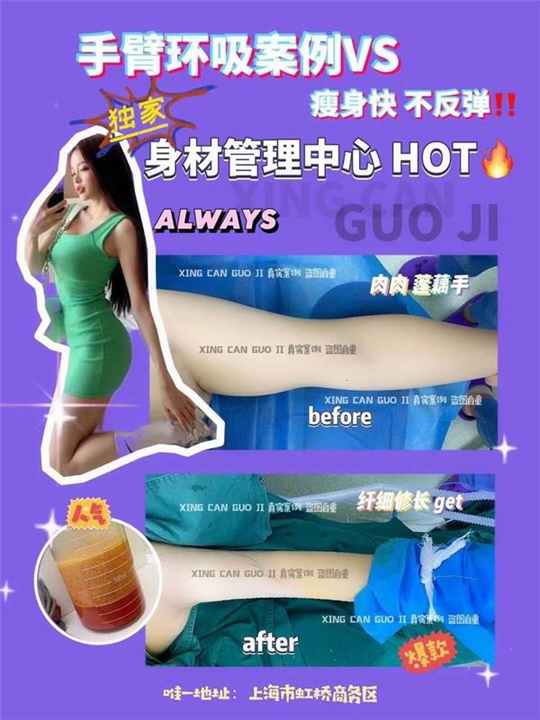 上海高级脸打造整形