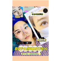 星璨少女动感双眼皮案例 