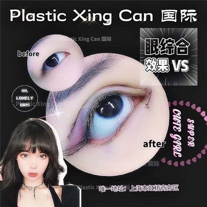 奢悦眼综合**案例 