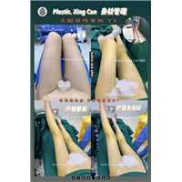 上海网红整形