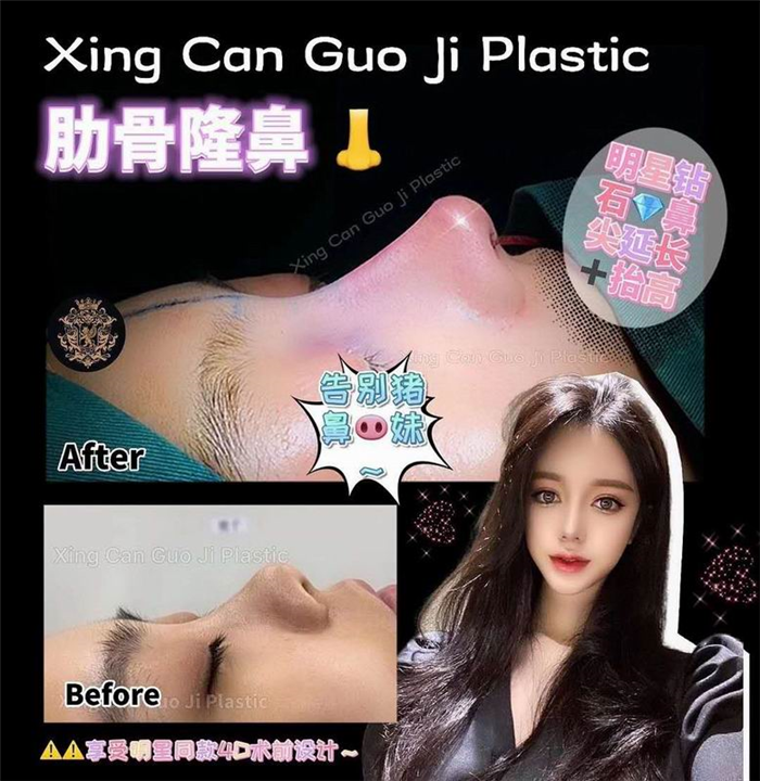 上海鼻综合整形