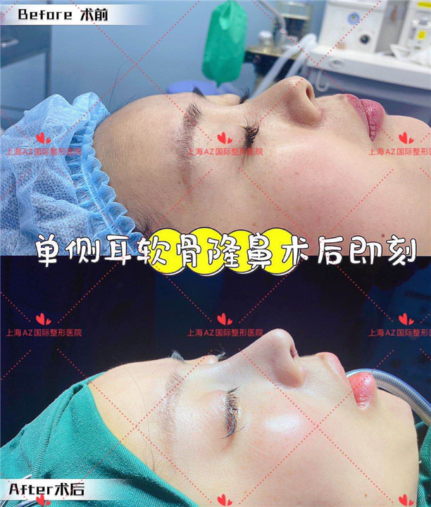 AZ国际整形