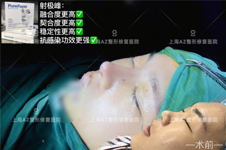 AZ国际整形医院