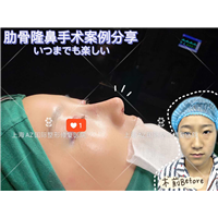上海AZ整形