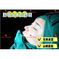 上海AZ国际整形上海AZ国际整形医院 