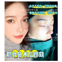 上海AZ国际整形上海AZ国际整形医院 
