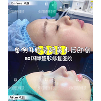 上海AZ国际整形上海AZ国际整形医院 