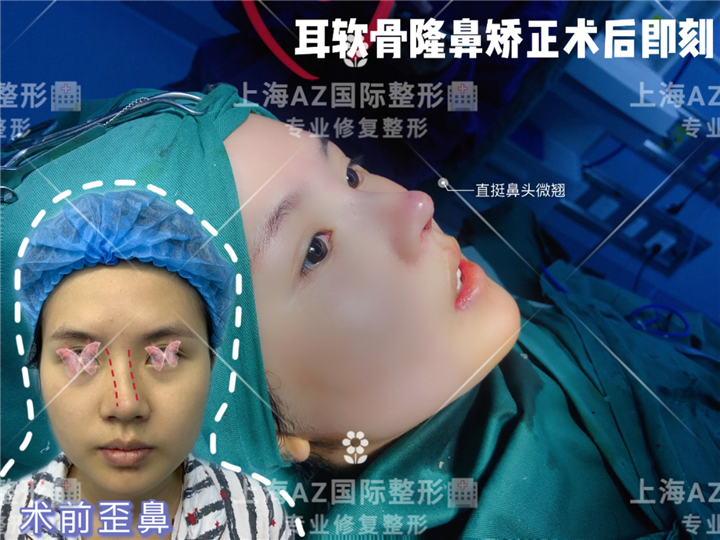 上海AZ国际整形
