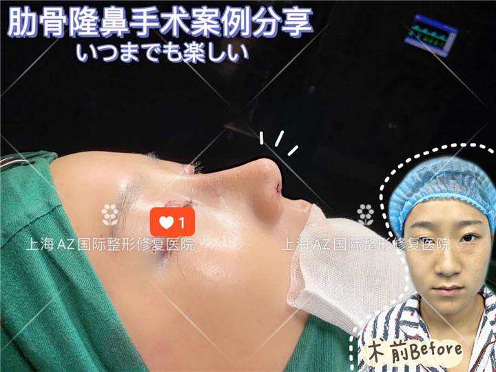 上海AZ整形