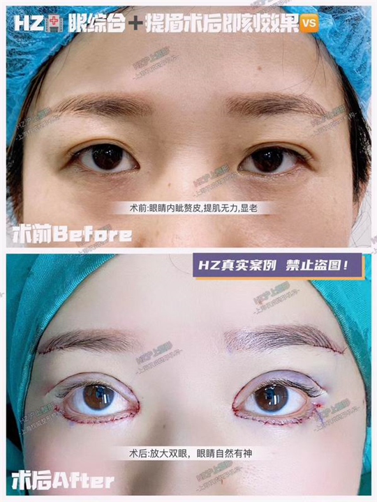 沪上整形修复