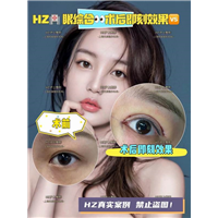 HZ眼综合整形 