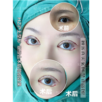 沪上眼综合整形
