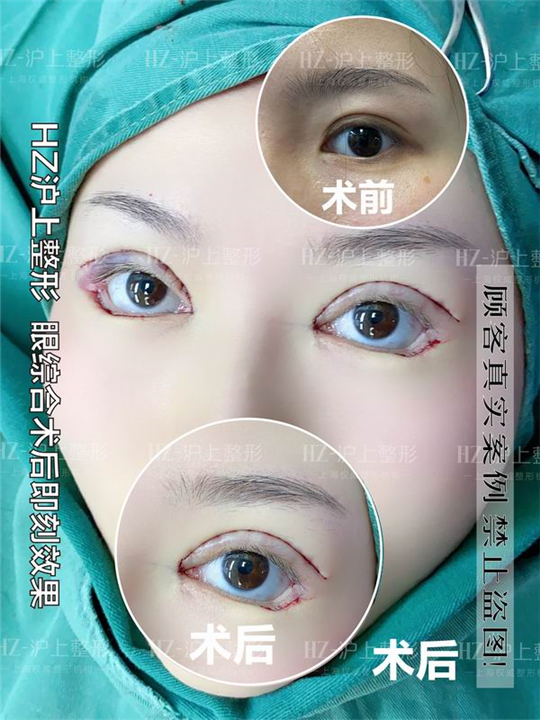沪上眼综合整形