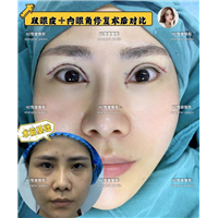 沪上眼综合整形