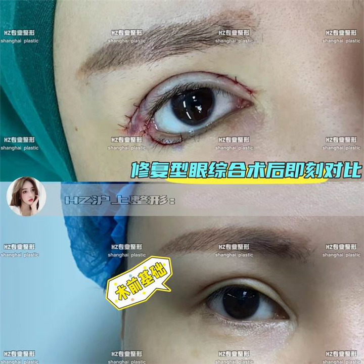 沪上整形修复