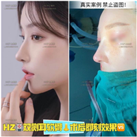 上海鼻综合整形