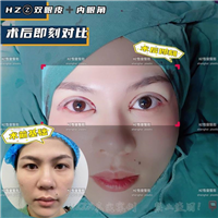 上海沪上眼综合整形
