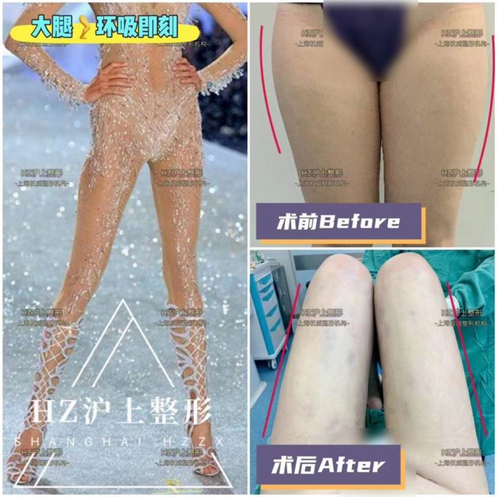 沪上整形团队
