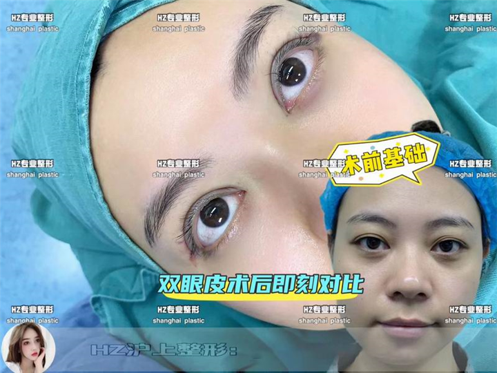 沪上整形修复