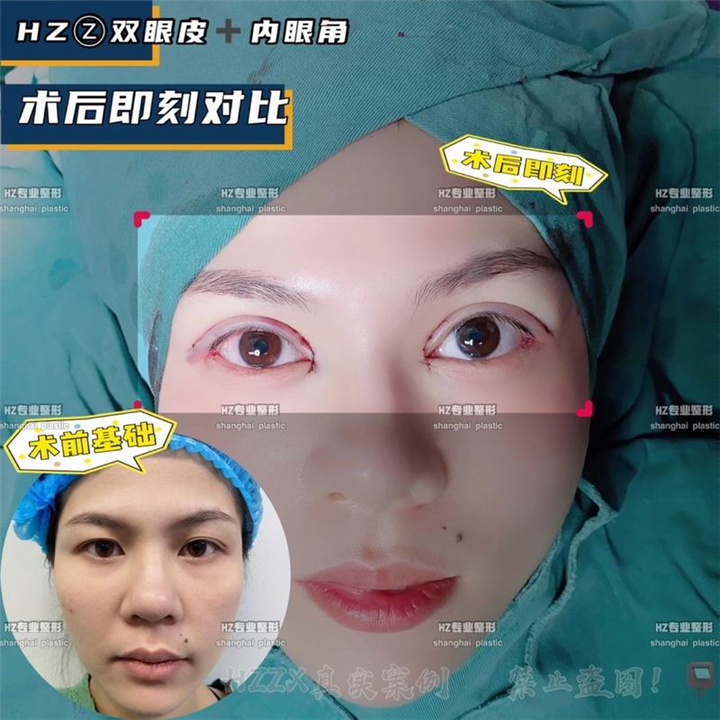上海沪上眼综合整形