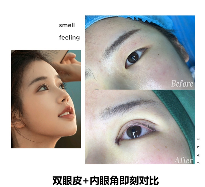 许昌眼综合整形 