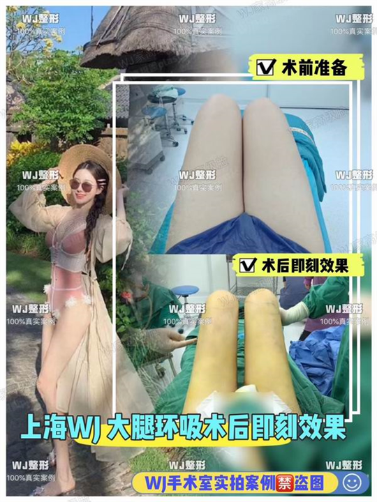 上海WJ唯姬雅整形