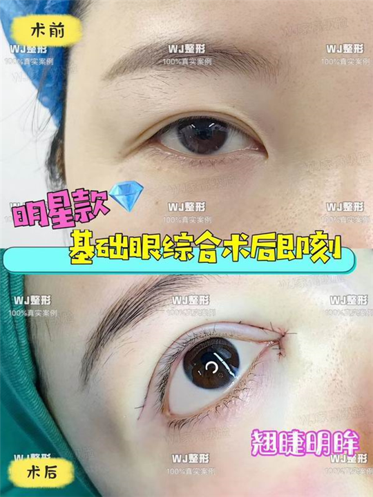 上海眼综合整形修复专家