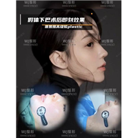 上海专业整形修复