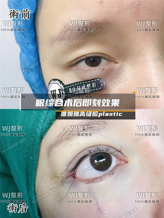 上海眼综合整形修复专家