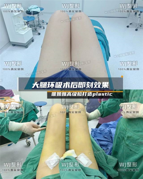 上海WJ唯姬雅整形
