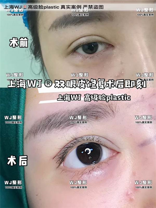 上海眼综合整形修复专家