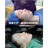 上海专业整形修复