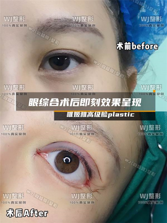 上海眼综合整形修复专家